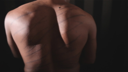 Channel 4 News can reveal mounting evidence that the government is still torturing Tamil prisoners.